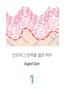 ϰ ź  Ǻ(Aged Skin)